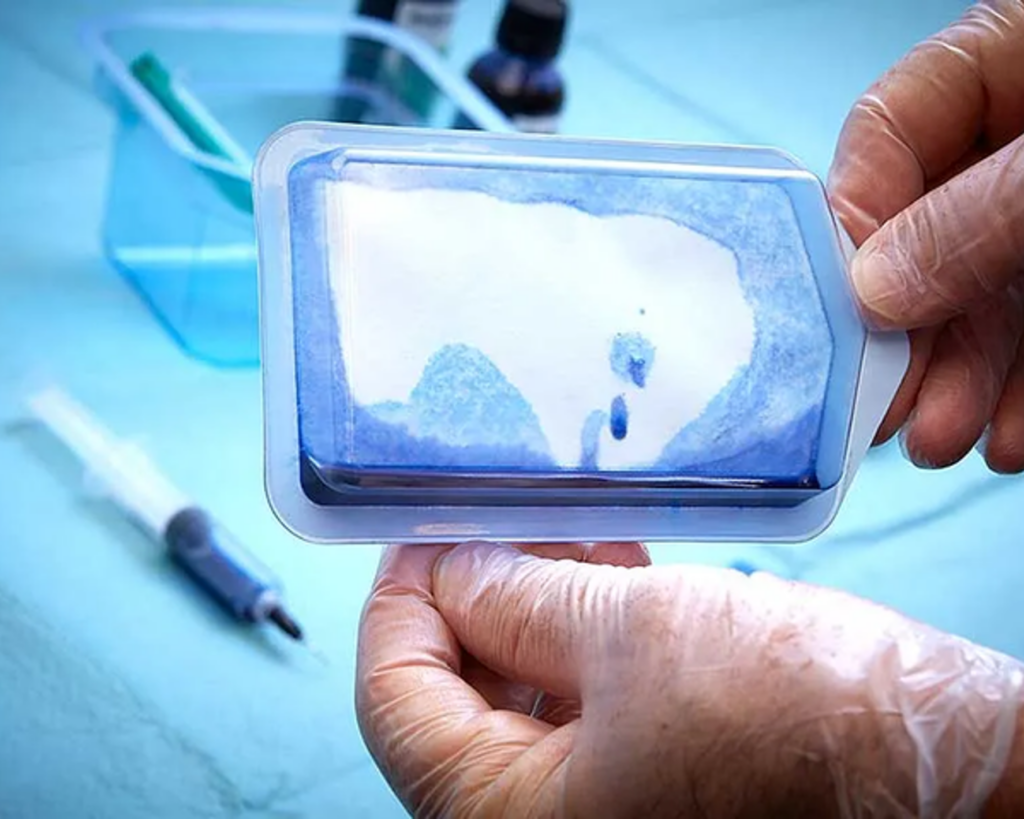 dye penetration
